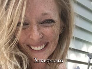Xfreckledx